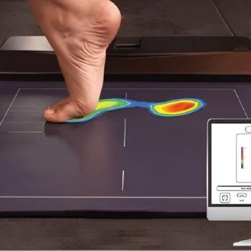 Foot-Plantar-Pressure-Analysis