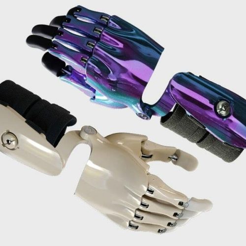 Wrist-Disarticulation-Partial-Hand